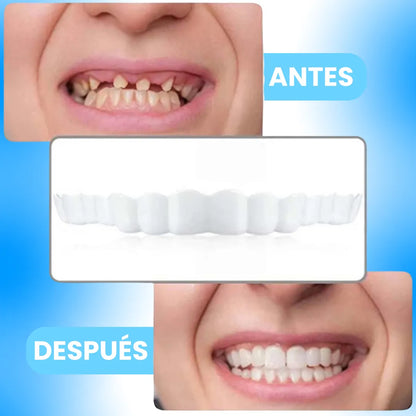 HappySmile®  Carillas Dentales 👄😁