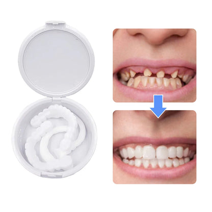 SmilePerfect - Pack Dental - COMPRE 1 LLEVE 1 GRATIS