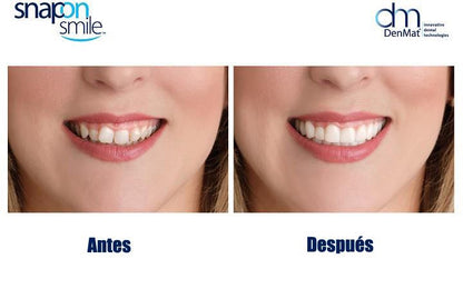 SmilePerfect - Pack Dental - COMPRE 1 LLEVE 1 GRATIS